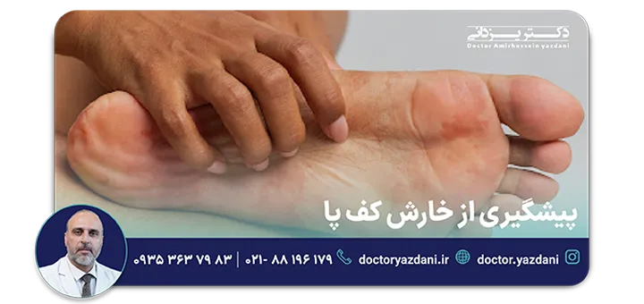 پیشگیری از خارش کف پا